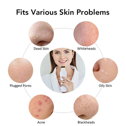 Ultrasonic Skin Scrubber Peeling Remove